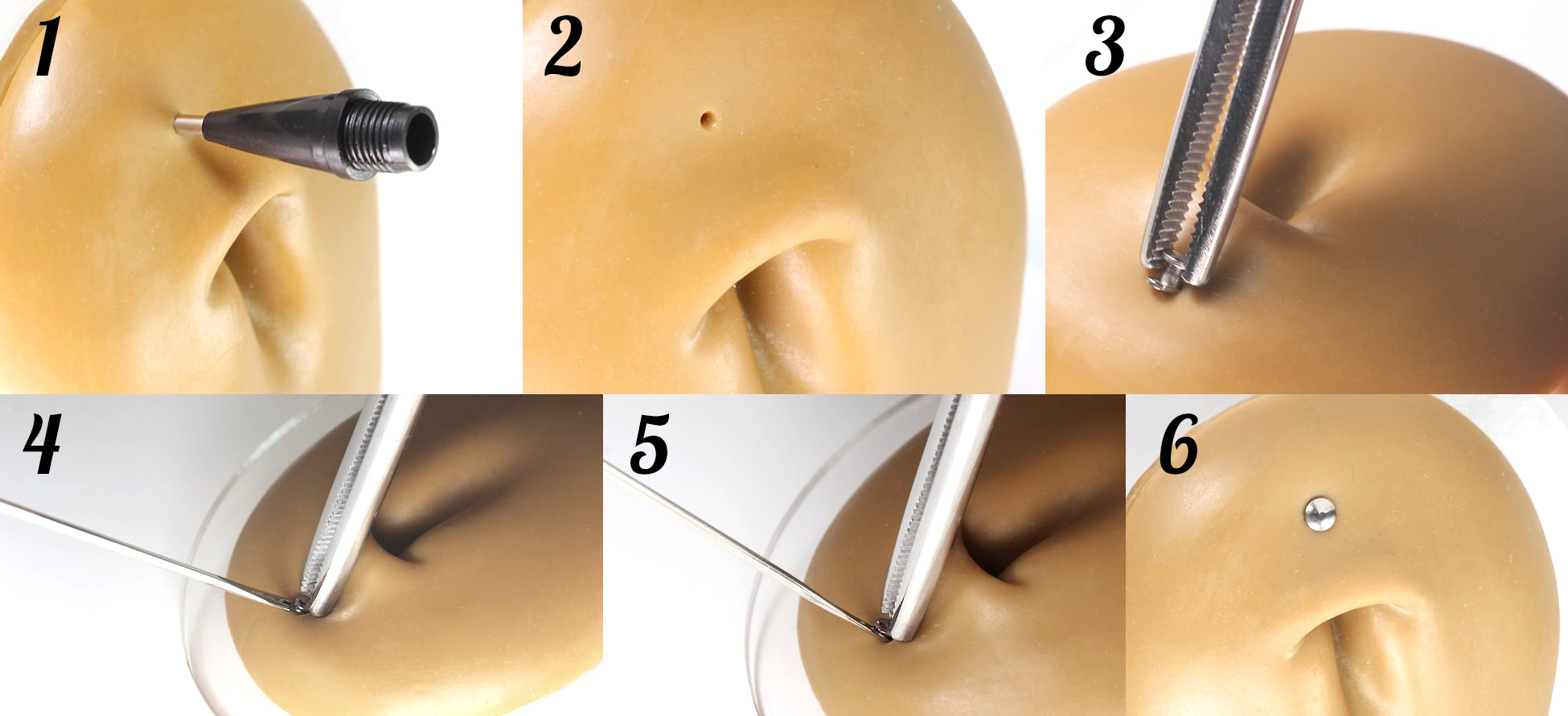 Dermal anchor segédeszköz